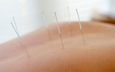 How Does Acupuncture Work?