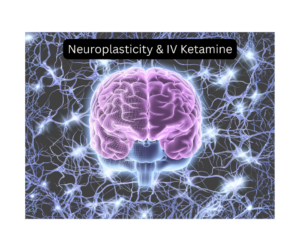 Illustration of the brain and neural connections used for a blog about IV ketamine therapy in Lincoln Nebraska at Elevate Mind & Mood